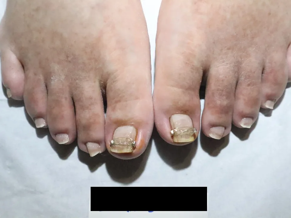 CASE 01 치료 후