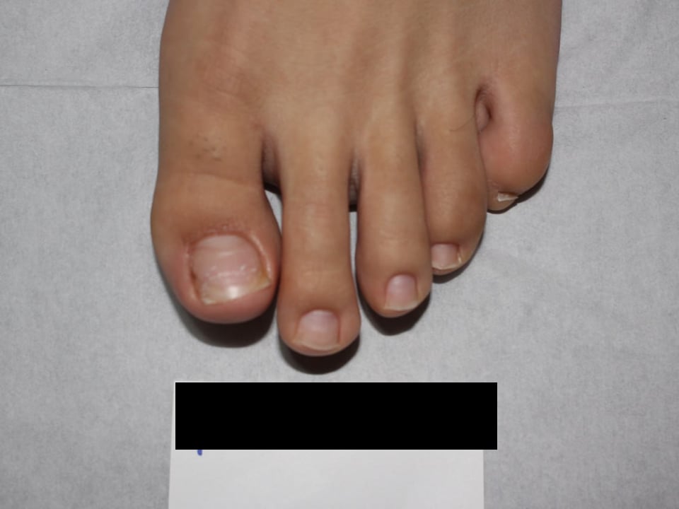 CASE 01 치료 후