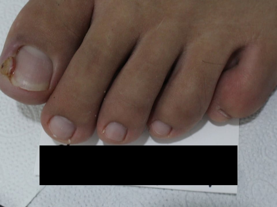 CASE 01 치료 전