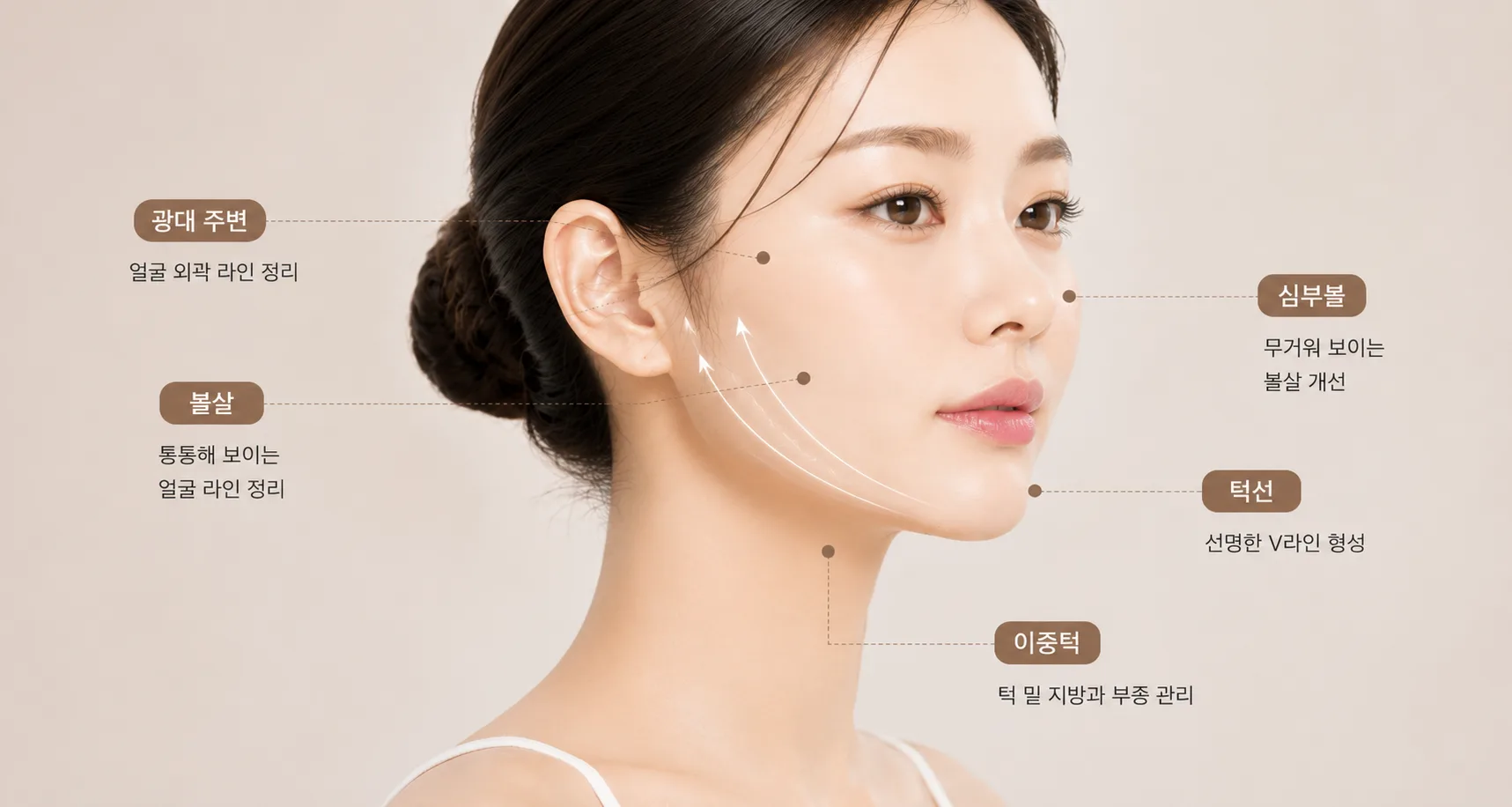 이미지로 보는 시술 부위