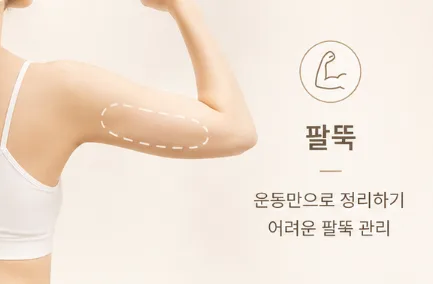 이미지로 보는 시술 부위 3