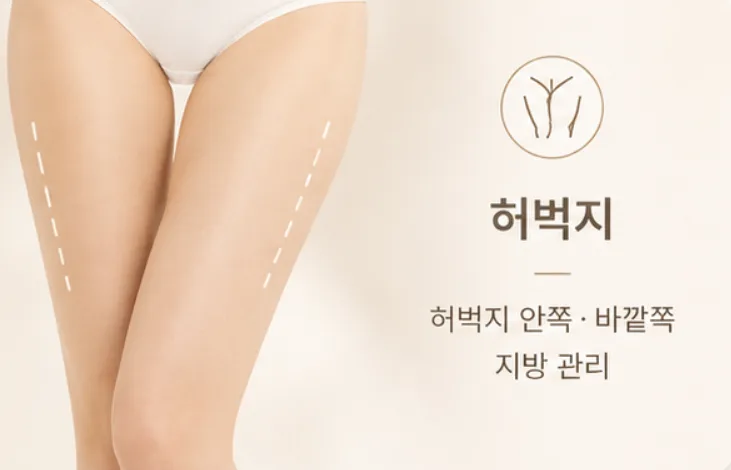 이미지로 보는 시술 부위 4