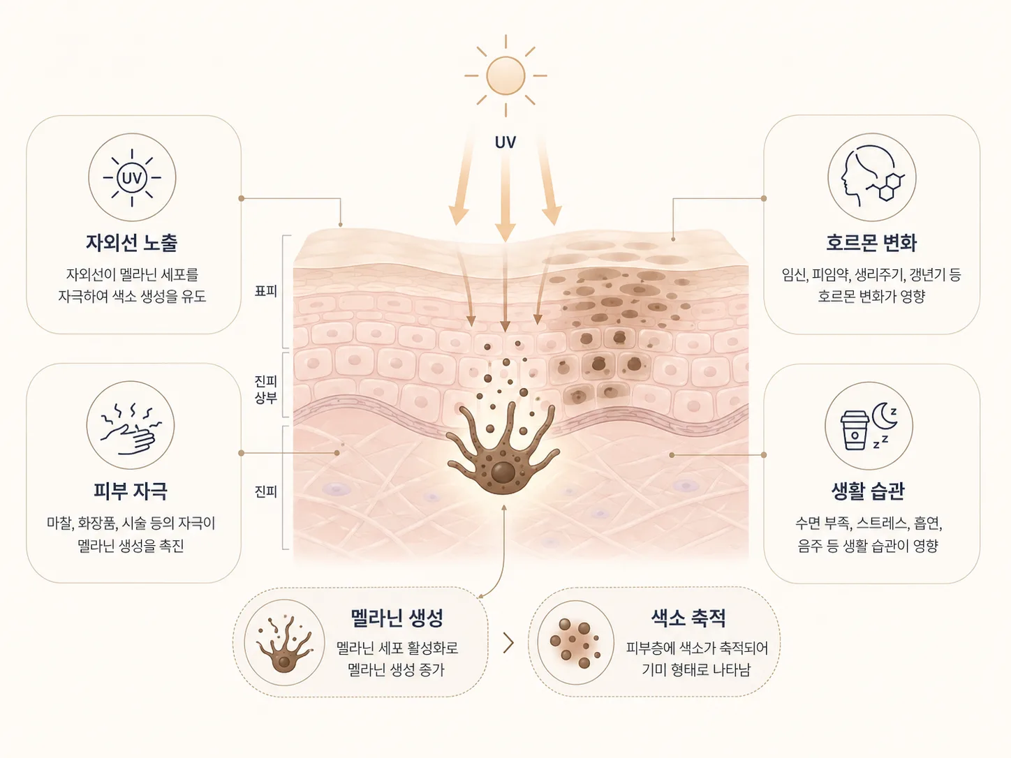 기미는 왜 생길까요?